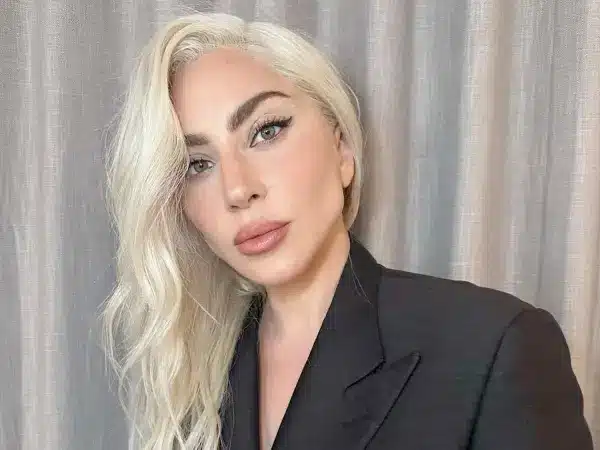 Lady Gaga et l'Affaire de Vol de Chiens